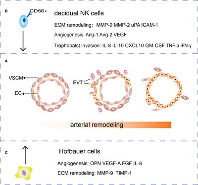 Hyperglycemia disturbs trophoblast functions and subsequently leads to failure of uterine spiral artery remodeling
